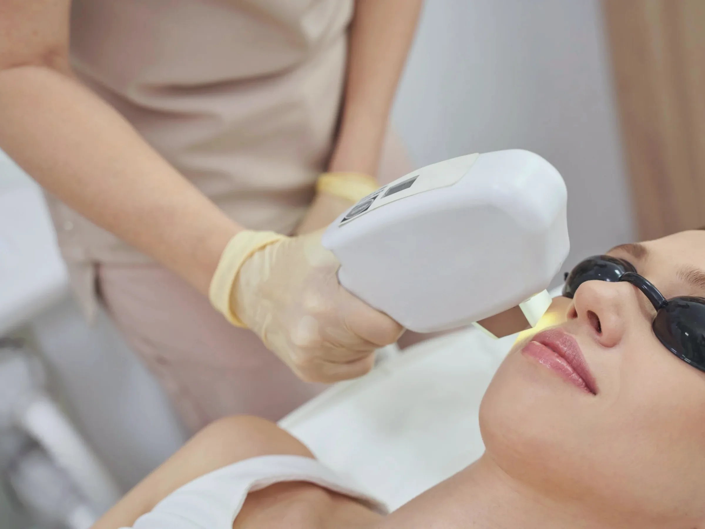 A gloved clinician treating a patient's face with an IPL handpiece, protective eyewear on