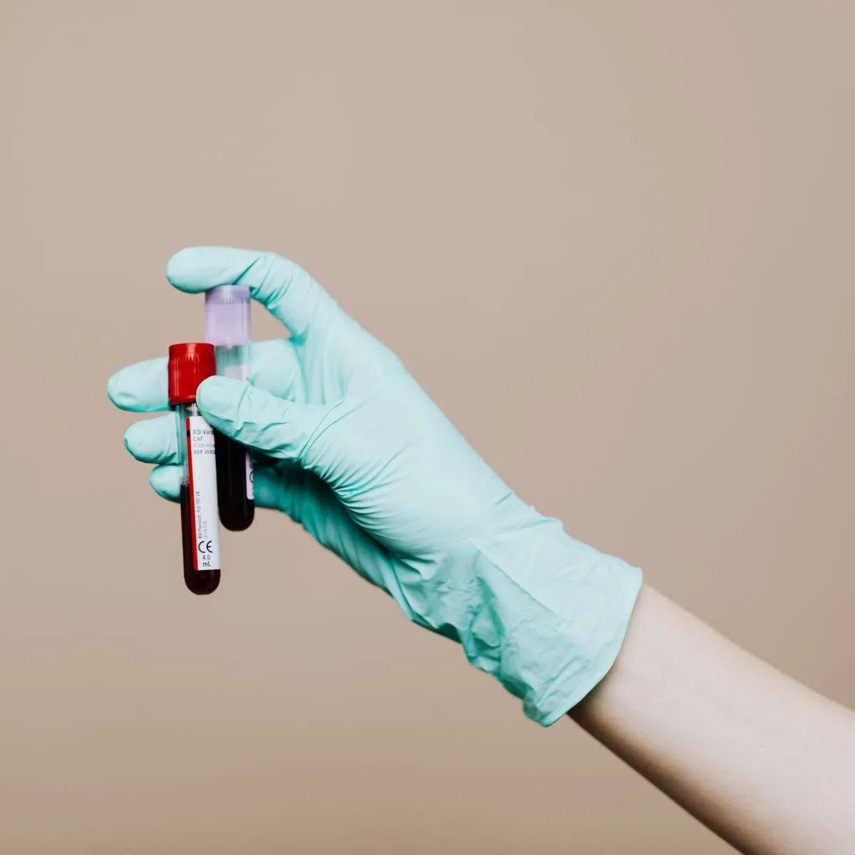 On-site bloodwork and lab testing at VitaleHEALTH in Flower Mound