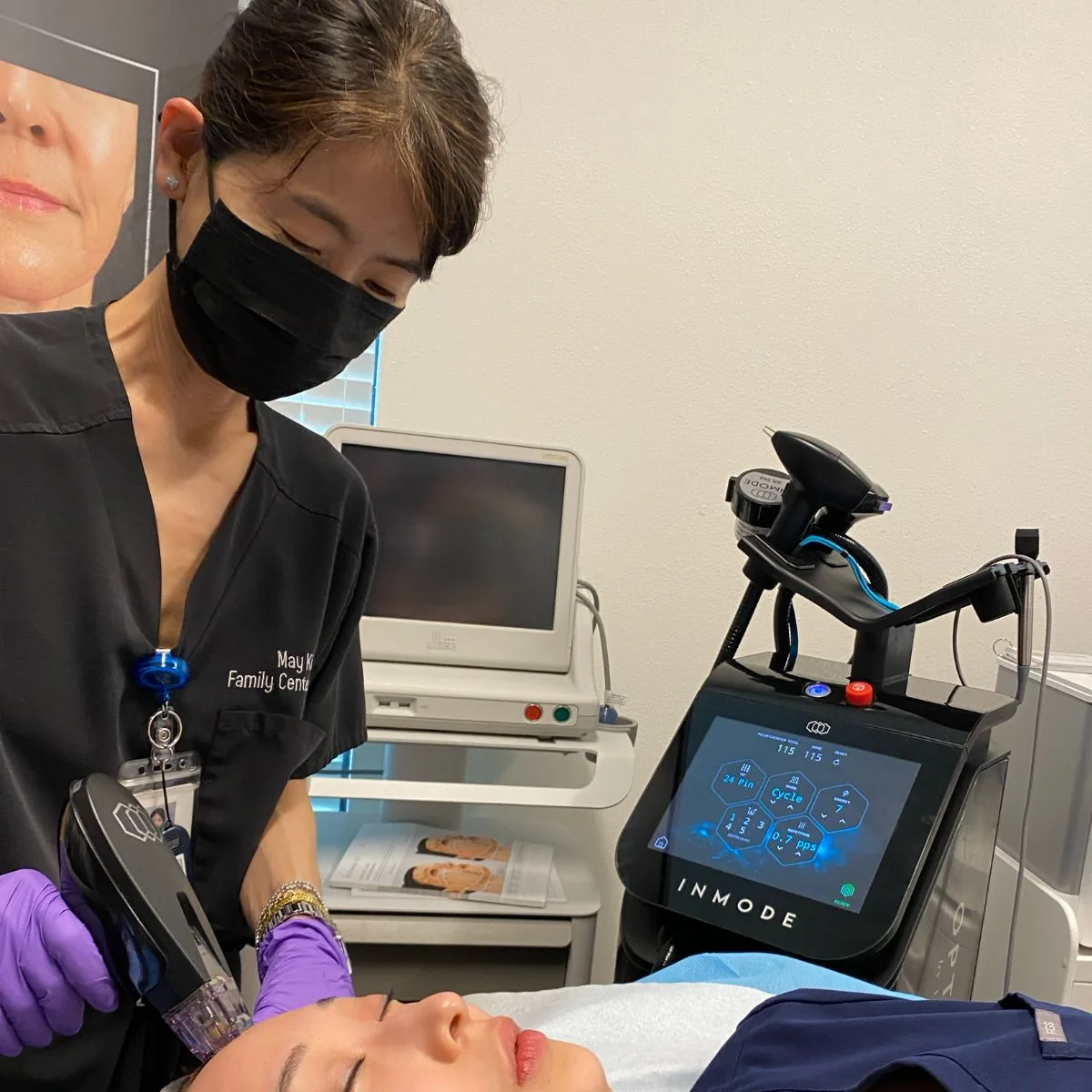Physician-performed Morpheus8 RF microneedling treatment at VitaleHEALTH Med Spa in Flower Mound